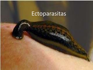 Ectoparasitas
 
