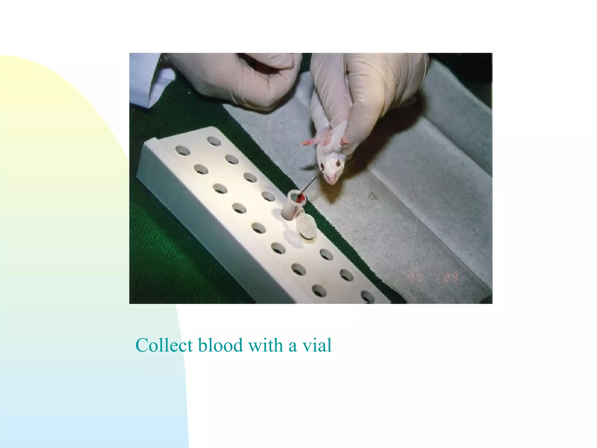 Collect blood with a vial
 
