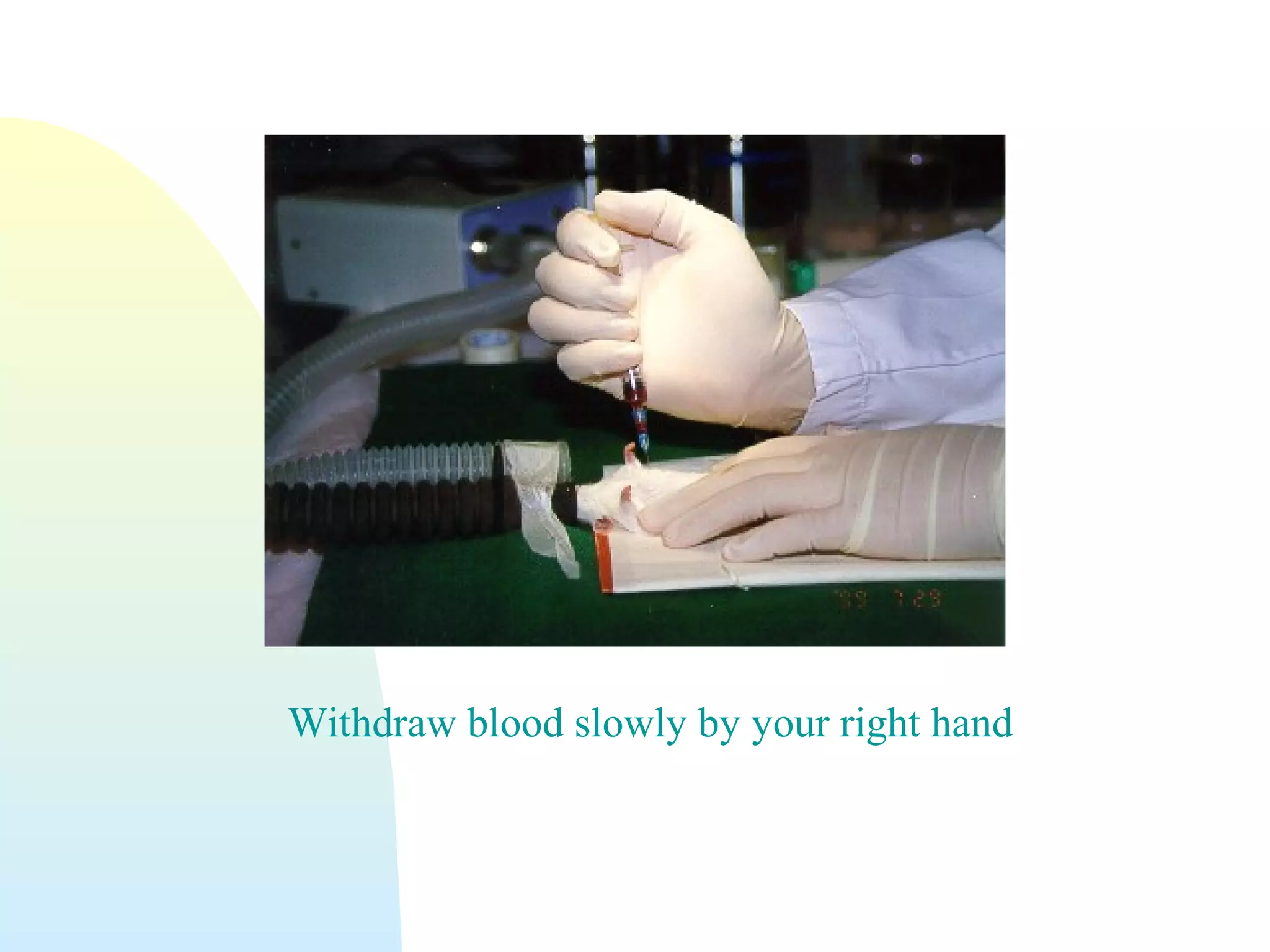 Withdraw blood slowly by your right hand
 