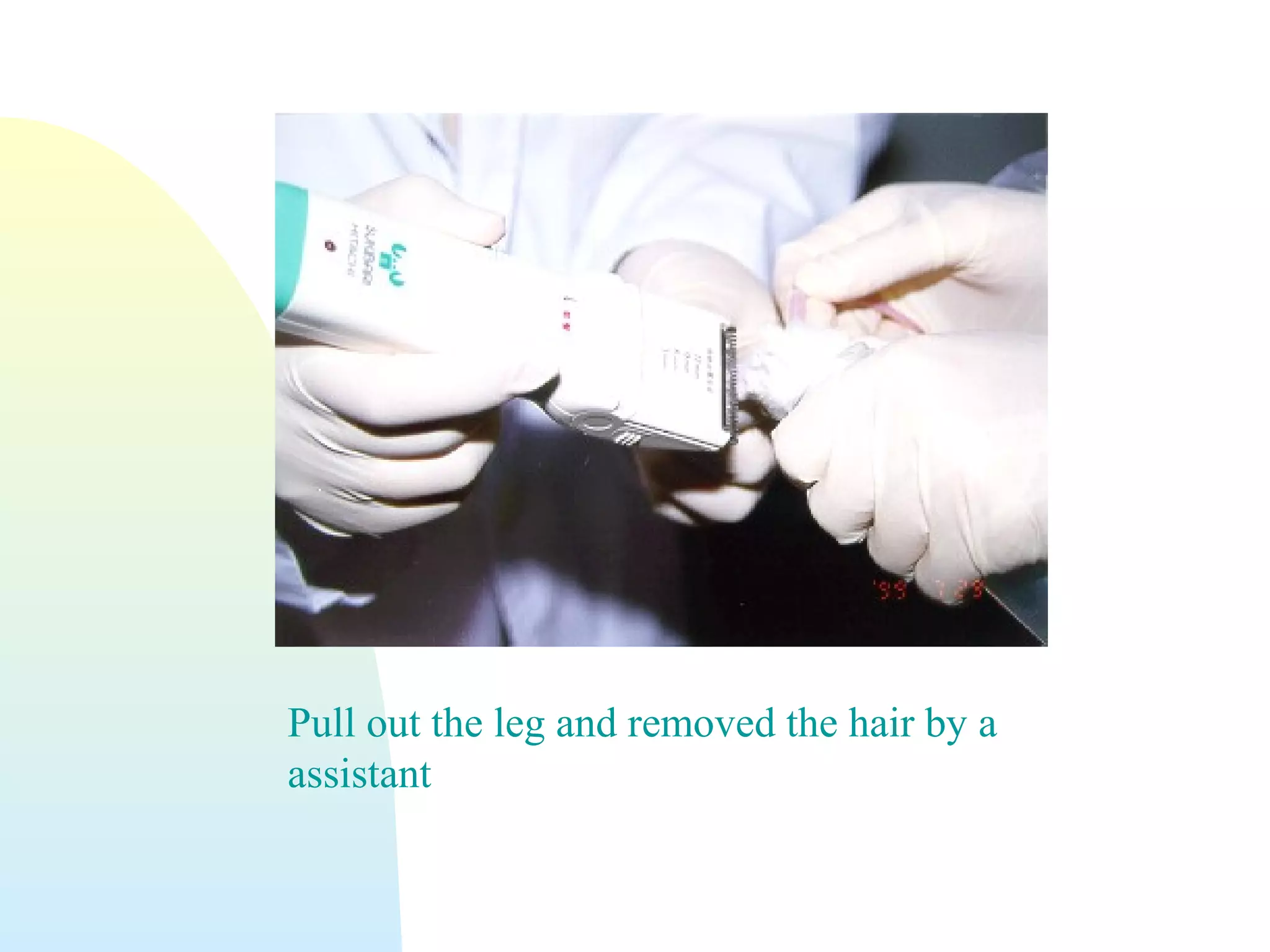 Pull out the leg and removed the hair by a
assistant
 