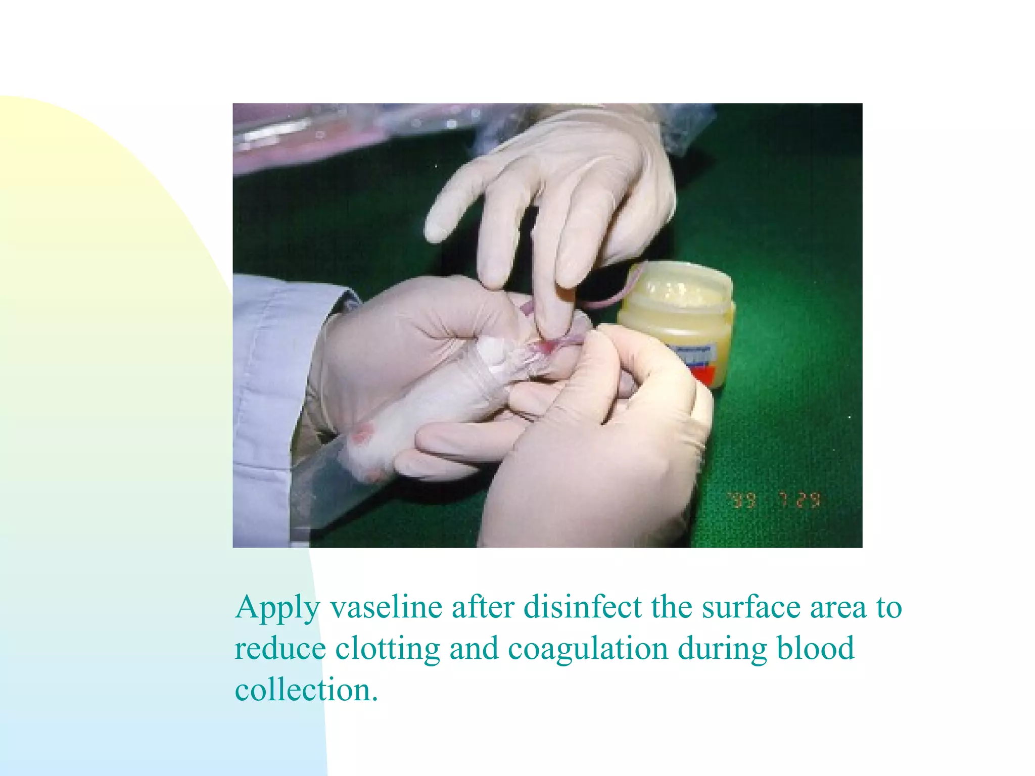 Apply vaseline after disinfect the surface area to
reduce clotting and coagulation during blood
collection.
 