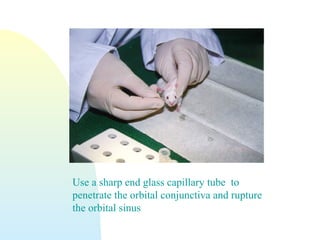 Use a sharp end glass capillary tube to
penetrate the orbital conjunctiva and rupture
the orbital sinus
 