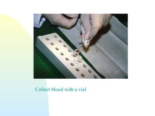 Collect blood with a vial
 
