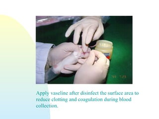Apply vaseline after disinfect the surface area to
reduce clotting and coagulation during blood
collection.
 
