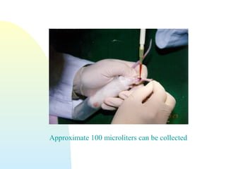 Approximate 100 microliters can be collected
 