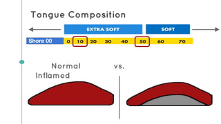 Normal vs.
Inflamed
Tongue Composition
Shore 00
 