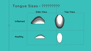 Tongue Sizes - ?????????
Inflamed
Healthy
Top ViewSide View
 