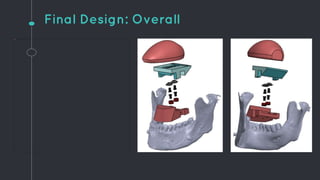 Final Design: Overall
 