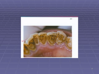 Acro Tooth Comprehensive Overview of Tooth Abnormalities and Their Clinical ...