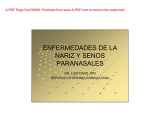 27/11/2013
ENFERMEDADES DE LA
NARIZ Y SENOS
PARANASALES
DR. LUIS CANO JON
SERVICIO OTORRINOLARINGOLOGIA
A-PDF Page Cut DEMO: Purchase from www.A-PDF.com to remove the watermark
 