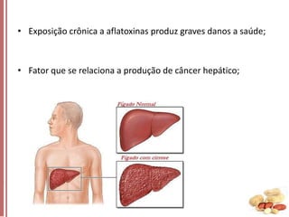 • Exposição crônica a aflatoxinas produz graves danos a saúde;

• Fator que se relaciona a produção de câncer hepático;

 