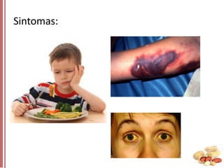 Sintomas:

 