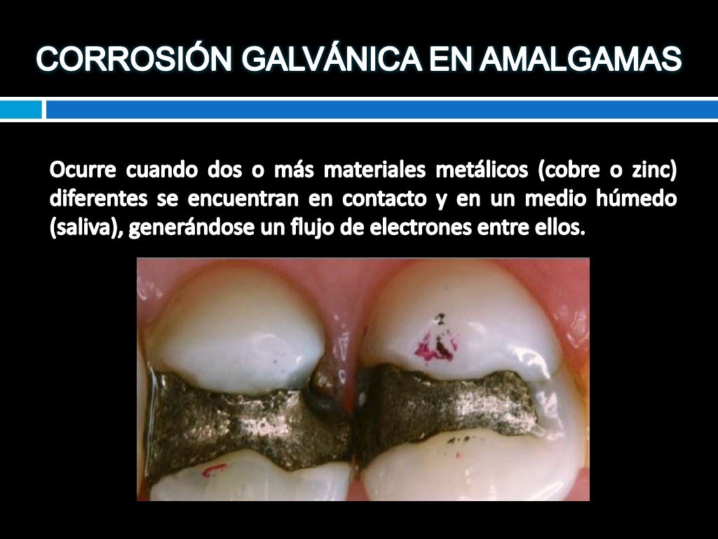 Amalgamas