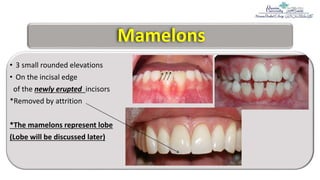 2= Anatomical landmarks and dental tissues.pptx