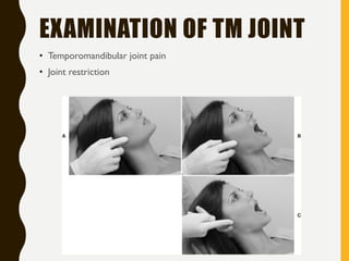 2 anatomy & physiology of tmj2 | PDF