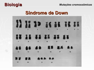 BiologiaBiologia Mutações cromossômicas
Síndrome de DownSíndrome de Down
 