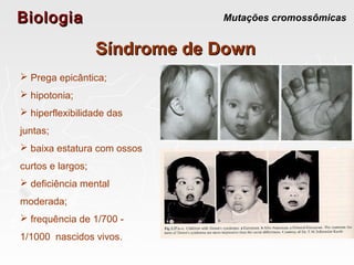 BiologiaBiologia Mutações cromossômicas
Síndrome de DownSíndrome de Down
 Prega epicântica;
 hipotonia;
 hiperflexibilidade das
juntas;
 baixa estatura com ossos
curtos e largos;
 deficiência mental
moderada;
 frequência de 1/700 -
1/1000 nascidos vivos.
 