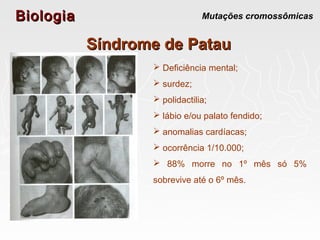 BiologiaBiologia Mutações cromossômicas
Síndrome de PatauSíndrome de Patau
 Deficiência mental;
 surdez;
 polidactilia;
 lábio e/ou palato fendido;
 anomalias cardíacas;
 ocorrência 1/10.000;
 88% morre no 1º mês só 5%
sobrevive até o 6º mês.
 