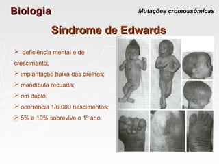 BiologiaBiologia Mutações cromossômicas
Síndrome de EdwardsSíndrome de Edwards
 deficiência mental e de
crescimento;
 implantação baixa das orelhas;
 mandíbula recuada;
 rim duplo;
 ocorrência 1/6.000 nascimentos;
 5% a 10% sobrevive o 1º ano.
 