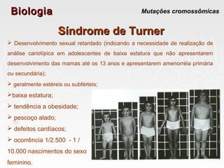 BiologiaBiologia Mutações cromossômicas
Síndrome de TurnerSíndrome de Turner
baixa estatura;
 tendência a obesidade;
 pescoço alado;
 defeitos cardíacos;
 ocorrência 1/2.500 - 1 /
10.000 nascimentos do sexo
feminino.
 Desenvolvimento sexual retardado (indicando a necessidade de realização de
análise cariotípica em adolescentes de baixa estatura que não apresentarem
desenvolvimento das mamas até os 13 anos e apresentarem amenorréia primária
ou secundária);
 geralmente estéreis ou subférteis;
 