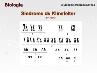BiologiaBiologia Mutações cromossômicas
Síndrome de KlinefelterSíndrome de Klinefelter
47, XXY
 