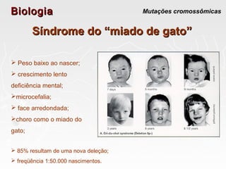 BiologiaBiologia Mutações cromossômicas
Síndrome do “miado de gato”Síndrome do “miado de gato”
 Peso baixo ao nascer;
 crescimento lento
deficiência mental;
microcefalia;
 face arredondada;
choro como o miado do
gato;
 85% resultam de uma nova deleção;
 freqüência 1:50.000 nascimentos.
 