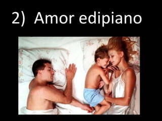 2) Amor edipiano
 
