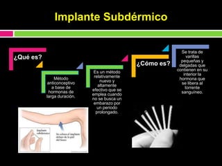 ¿Qué es?
Método
anticonceptivo
a base de
hormonas de
larga duración.
Es un método
relativamente
nuevo y
altamente
efectivo que se
emplea cuando
no se busca un
embarazo por
un periodo
prolongado.
¿Cómo es?
Se trata de
varillas
pequeñas y
delgadas que
contienen en su
interior la
hormona que
se libera al
torrente
sanguíneo.
Implante Subdérmico
 