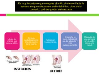 Lávate las
manos con
agua y jabón.
Empuja
cuidadosamente
el anillo dentro
de la vagina.
Retíralo en
tres semanas.
Engancha tu
dedo debajo del
aro de adelante y
retira
cuidadosamente.
Después de
una semana
sin el anillo,
coloca uno
nuevo.
Es muy importante que coloques el anillo el mismo día de la
semana en que colocaste el anillo del último ciclo; de lo
contrario, podrías quedar embarazada.
 