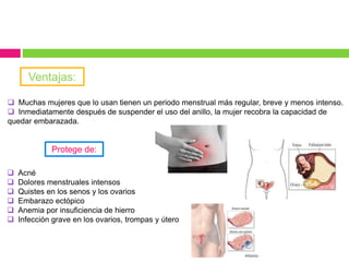 Muchas mujeres que lo usan tienen un periodo menstrual más regular, breve y menos intenso.
 Inmediatamente después de suspender el uso del anillo, la mujer recobra la capacidad de
quedar embarazada.
Ventajas:
Protege de:
 Acné
 Dolores menstruales intensos
 Quistes en los senos y los ovarios
 Embarazo ectópico
 Anemia por insuficiencia de hierro
 Infección grave en los ovarios, trompas y útero
 