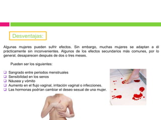 Algunas mujeres pueden sufrir efectos. Sin embargo, muchas mujeres se adaptan a él
prácticamente sin inconvenientes. Algunos de los efectos secundarios más comunes, por lo
general, desaparecen después de dos o tres meses.
Pueden ser los siguientes:
 Sangrado entre periodos menstruales
 Sensibilidad en los senos
 Náusea y vómito
 Aumento en el flujo vaginal, irritación vaginal o infecciones.
 Las hormonas podrían cambiar el deseo sexual de una mujer.
Desventajas:
 
