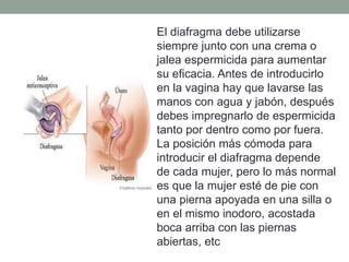 El diafragma debe utilizarse
siempre junto con una crema o
jalea espermicida para aumentar
su eficacia. Antes de introducirlo
en la vagina hay que lavarse las
manos con agua y jabón, después
debes impregnarlo de espermicida
tanto por dentro como por fuera.
La posición más cómoda para
introducir el diafragma depende
de cada mujer, pero lo más normal
es que la mujer esté de pie con
una pierna apoyada en una silla o
en el mismo inodoro, acostada
boca arriba con las piernas
abiertas, etc
 