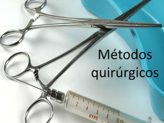 Métodos
quirúrgicos
 
