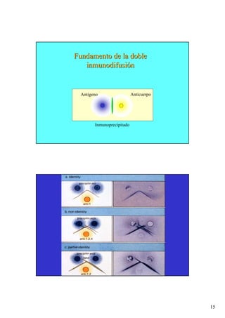 15
Fundamento de la doble
Fundamento de la doble
inmunodifusi
inmunodifusió
ón
n
Antígeno Anticuerpo
Inmunoprecipitado
 