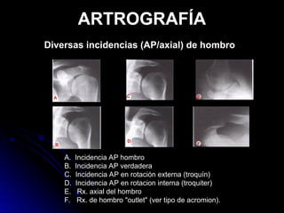 RADIOLOGIA DEL APARATO LOCOMOTOR 2014.ppt
