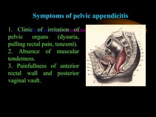 Appendicitis - disease, etiology, treatment | PPT