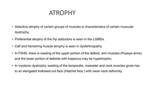 Clinical approach to myopathy and management.pptx
