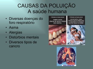 CAUSAS DA POLUIÇÃO
         A saúde humana
• Diversas doenças do
  foro respiratório
• Asma
• Alergias
• Distúrbios mentais
• Diversos tipos de
  cancro
 