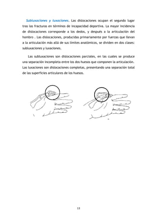 13
Subluxaciones y luxaciones. Las dislocaciones ocupan el segundo lugar
tras las fracturas en términos de incapacidad deportiva. La mayor incidencia
de dislocaciones corresponde a los dedos, y después a la articulación del
hombro . Las dislocaciones, producidas primariamente por fuerzas que llevan
a la articulación más allá de sus límites anatómicos, se dividen en dos clases:
subluxaciones y luxaciones.
Las subluxaciones son dislocaciones parciales, en las cuales se produce
una separación incompleta entre los dos huesos que componen la articulación.
Las luxaciones son dislocaciones completas, presentando una separación total
de las superficies articulares de los huesos.
 