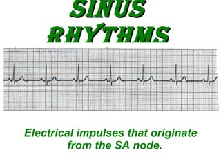 Sinus Rhythms ,[object Object]