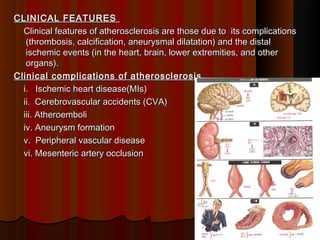 2 atherosclerosis pathology | PPT