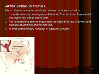 Fistula Rupture 2 atherosclerosis pathology | PPT