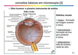 conceitos básicos em microscopia [2]
¾ Olho humano: o pioneiro instrumento de análise
1>
Defeitos visuais:
ƒ miopia – formação
da imagem anterior
à retina.
ƒ hipermetropia –
formação da ima-
gem posterior
à retina.
ƒ astigmatismo –
falta de simetria
radial do olho.
 