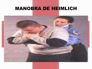 MANOBRA DE HEIMLICH
 