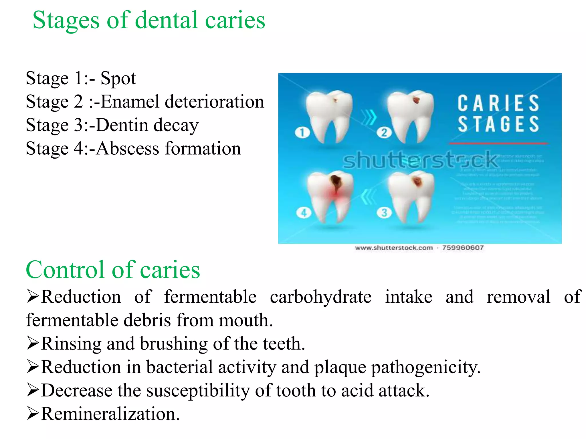 Stages of dental caries
Stage 1:- Spot
Stage 2 :-Enamel deterioration
Stage 3:-Dentin decay
Stage 4:-Abscess formation
Control of caries
Reduction of fermentable carbohydrate intake and removal of
fermentable debris from mouth.
Rinsing and brushing of the teeth.
Reduction in bacterial activity and plaque pathogenicity.
Decrease the susceptibility of tooth to acid attack.
Remineralization.
 