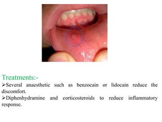 problem assso with oral cavity | PPTX