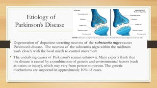 Etiology of
Parkinson’s Disease
• Degeneration of dopamine-secreting neurons of the substantia nigra causes
Parkinson’s disease. The neurons of the substantia nigra within the midbrain
work closely with the basal nuceli to control movement.
• The underlying causes of Parkinson’s remain unknown. Many experts think that
the disease is caused by a combination of genetic and environmental factors (such
as toxins or injury), which may vary from person to person. The genetic
mechanisms are suspected in approximately 10% of cases.
 