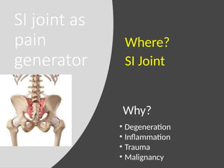 SI joint as
pain
generator
Why?
Where?
SI Joint
• Degeneration
• Inflammation
• Trauma
• Malignancy
 