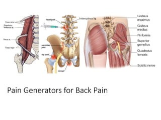 Pain Generators for Back Pain
 