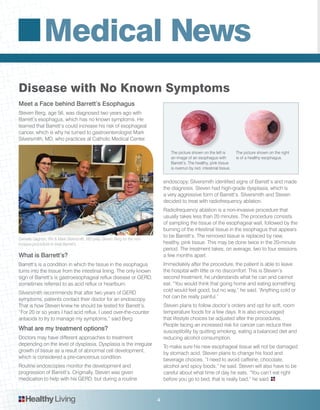 Medical News
4
Meet a Face behind Barrett’s Esophagus
Steven Berg, age 56, was diagnosed two years ago with
Barrett’s esophagus, which has no known symptoms. He
learned that Barrett’s could increase his risk of esophageal
cancer, which is why he turned to gastroenterologist Mark
Silversmith, MD, who practices at Catholic Medical Center.
What is Barrett’s?
Barrett’s is a condition in which the tissue in the esophagus
turns into the tissue from the intestinal lining. The only known
sign of Barrett’s is gastroesophageal reflux disease or GERD,
sometimes referred to as acid reflux or heartburn.
Silversmith recommends that after two years of GERD
symptoms, patients contact their doctor for an endoscopy.
That is how Steven knew he should be tested for Barrett’s.
“For 20 or so years I had acid reflux. I used over-the-counter
antacids to try to manage my symptoms,” said Berg
What are my treatment options?
Doctors may have different approaches to treatment
depending on the level of dysplasia. Dysplasia is the irregular
growth of tissue as a result of abnormal cell development,
which is considered a pre-cancerous condition.
Routine endoscopies monitor the development and
progression of Barrett’s. Originally, Steven was given
medication to help with his GERD, but during a routine
endoscopy, Silversmith identified signs of Barrett’s and made
the diagnosis. Steven had high-grade dysplasia, which is
a very aggressive form of Barrett’s. Silversmith and Steven
decided to treat with radiofrequency ablation.
Radiofrequency ablation is a non-invasive procedure that
usually takes less than 20 minutes. The procedure consists
of sampling the tissue of the esophageal wall, followed by the
burning of the intestinal tissue in the esophagus that appears
to be Barrett’s. The removed tissue is replaced by new,
healthy, pink tissue. This may be done twice in the 20-minute
period. The treatment takes, on average, two to four sessions
a few months apart.
Immediately after the procedure, the patient is able to leave
the hospital with little or no discomfort. This is Steven’s
second treatment, he understands what he can and cannot
eat. “You would think that going home and eating something
cold would feel good, but no way,” he said. “Anything cold or
hot can be really painful.”
Steven plans to follow doctor’s orders and opt for soft, room
temperature foods for a few days. It is also encouraged
that lifestyle choices be adjusted after the procedures.
People facing an increased risk for cancer can reduce their
susceptibility by quitting smoking, eating a balanced diet and
reducing alcohol consumption.
To make sure his new esophageal tissue will not be damaged
by stomach acid, Steven plans to change his food and
beverage choices. “I need to avoid caffeine, chocolate,
alcohol and spicy foods,” he said. Steven will also have to be
careful about what time of day he eats. “You can’t eat right
before you go to bed, that is really bad,” he said.
Disease with No Known Symptoms
Danielle Gagnon, RN & Mark Silversmith, MD prep Steven Berg for the non-
invasive procedure to treat Barrett’s.
HealthyLiving
The picture shown on the left is
an image of an esophagus with
Barrett’s. The healthy, pink tissue
is overrun by red, intestinal tissue.
The picture shown on the right
is of a healthy esophagus.
 